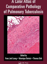 A Color Atlas of Comparative Pathology of Pulmonary Tuberculosis