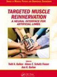 Targeted Muscle Reinnervation