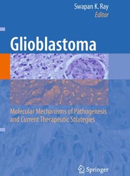 Glioblastoma: