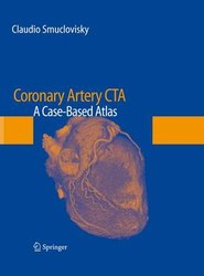 Coronary Artery CTA
