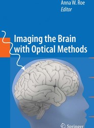 Imaging the Brain with Optical Methods