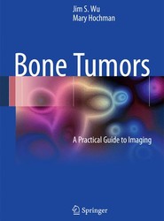 Bone Tumors