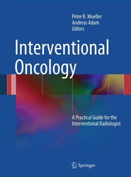 Interventional Oncology