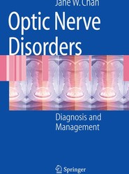 Optic Nerve Disorders