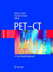 PET-CT