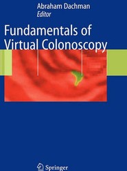 Fundamentals of Virtual Colonoscopy