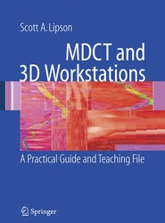 MDCT and 3D Workstations