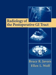 Radiology of the Postoperative GI Tract