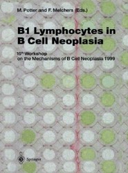 Presbyopia Research