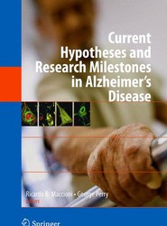 Current Hypotheses and Research Milestones in Alzheimer's Disease