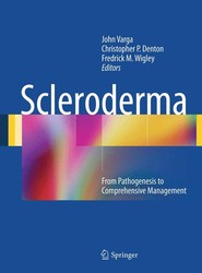Scleroderma
