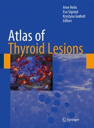 Atlas of Thyroid Lesions