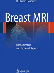 Breast MRI