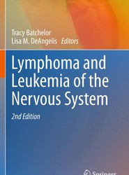Lymphoma and Leukemia of the Nervous System