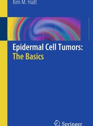 Epidermal Cell Tumors: The Basics