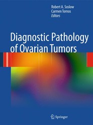Diagnostic Pathology of Ovarian Tumors