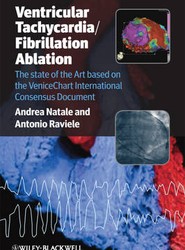 Ventricular Tachycardia / Fibrillation Ablation - The State of the Art based on the Venicechart International Consensus Document