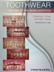 Toothwear - The ABC of the Worn Dentition