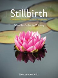 Stillbirth - Prediction, Prevention and Management