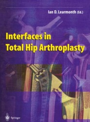 Interfaces in Total Hip Arthroplasty