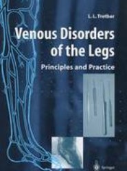 Venous Disorders of the Legs