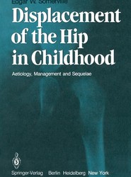 Displacement of the Hip in Childhood