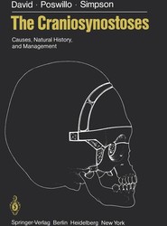 The Craniosynostoses