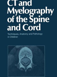 CT and Myelography of the Spine and Cord