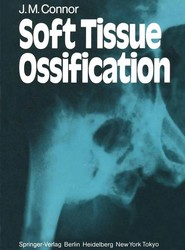Soft Tissue Ossification