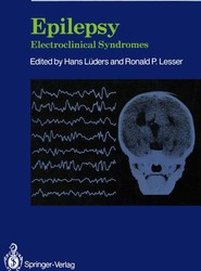 Epilepsy