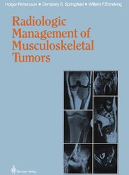 Radiologic Management of Musculoskeletal Tumors
