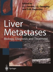 Liver Metastases
