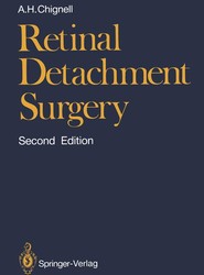 Retinal Detachment Surgery