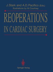 Reoperations in Cardiac Surgery