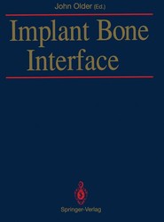Implant Bone Interface