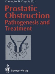 Prostatic Obstruction