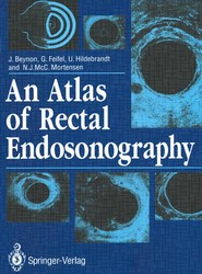 An Atlas of Rectal Endosonography