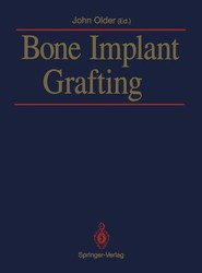 Bone Implant Grafting
