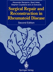 Surgical Repair and Reconstruction in Rheumatoid Disease