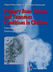 Primary Bone Tumors and Tumorous Conditions in Children