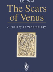 The Scars of Venus