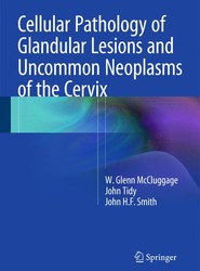 Cellular Pathology of Glandular Lesions and Uncommon Neoplasms of the Cervix
