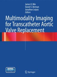 Multimodality Imaging for Transcatheter Aortic Valve Replacement