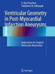 Ventricular Geometry in Post-Myocardial Infarction Aneurysms
