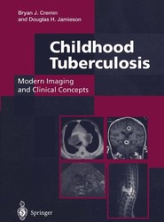 Childhood Tuberculosis: Modern Imaging and Clinical Concepts