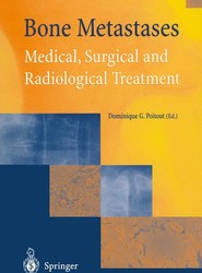Bone Metastases