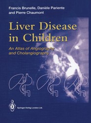 Liver Disease in Children