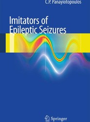 Imitators of epileptic seizures
