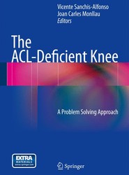 The ACL-Deficient Knee