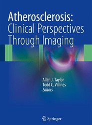 Atherosclerosis: Clinical Perspectives Through Imaging